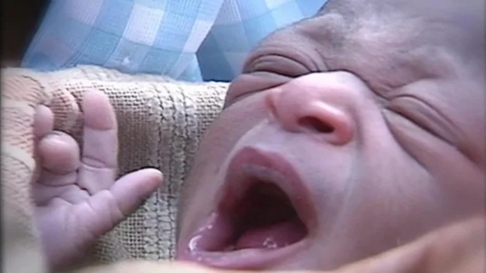 Mozambique’s “Miracle Baby” Dies at 25
